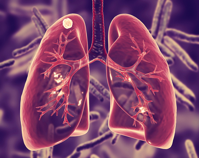 Всемирный день борьбы с туберкулезом